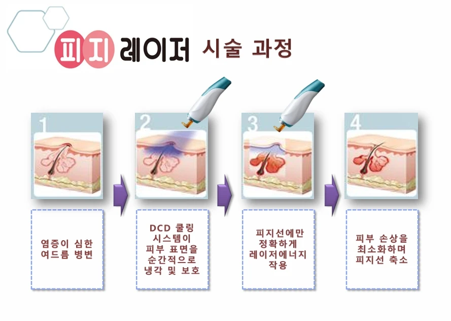 treatmentIntroduction