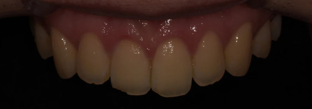 before_image