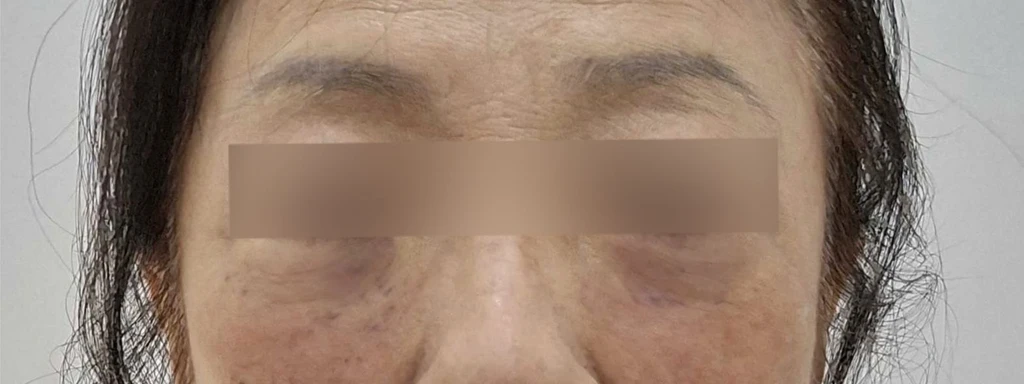 before_image