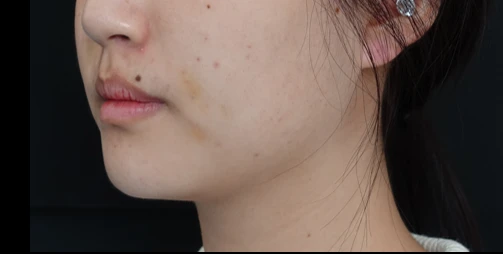 before_image