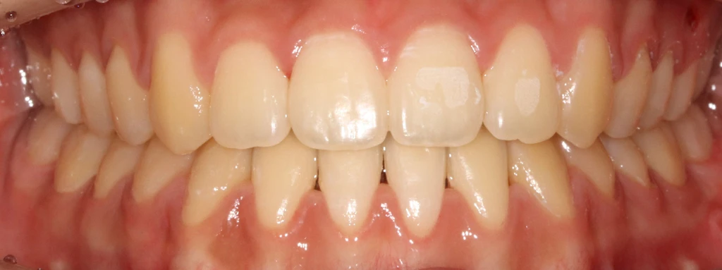 before_image