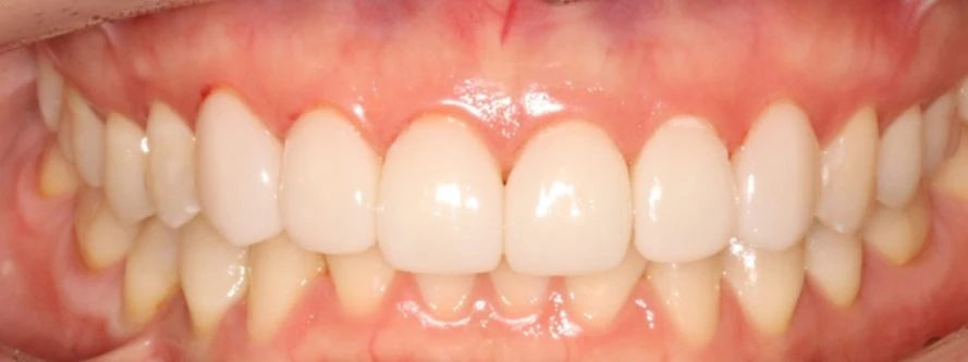 before_image
