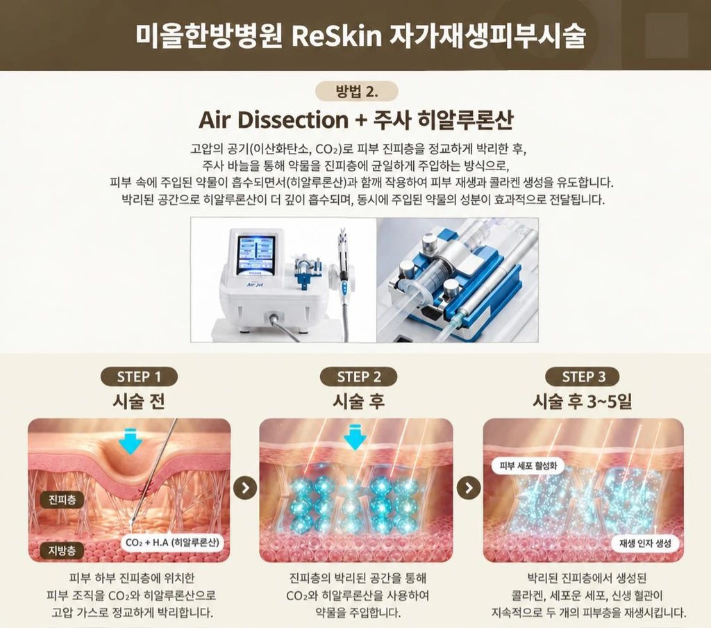 treatmentIntroduction