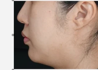 before_image