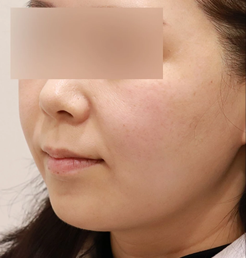 before_image