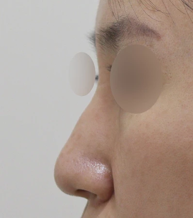 before_image