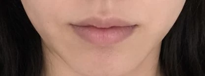 before_image