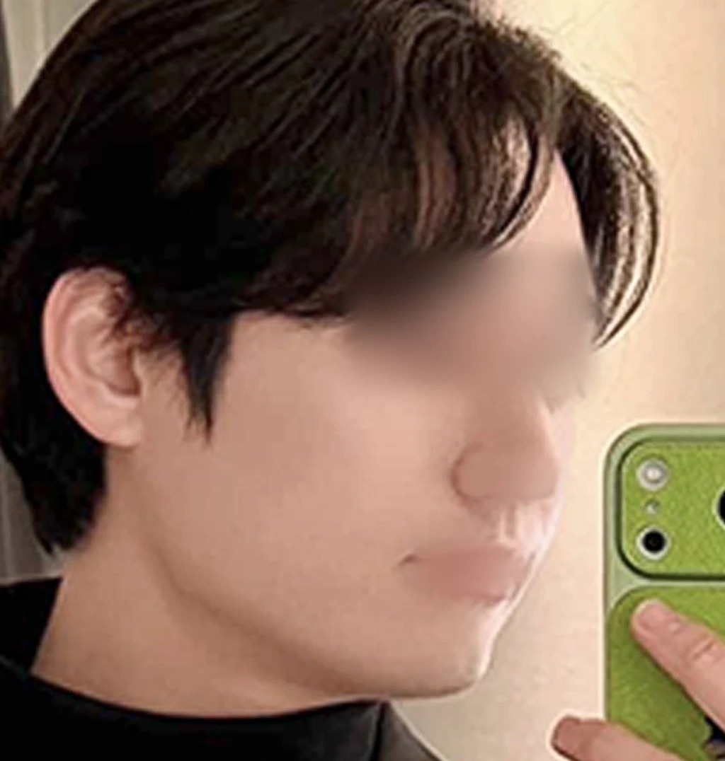 before_image