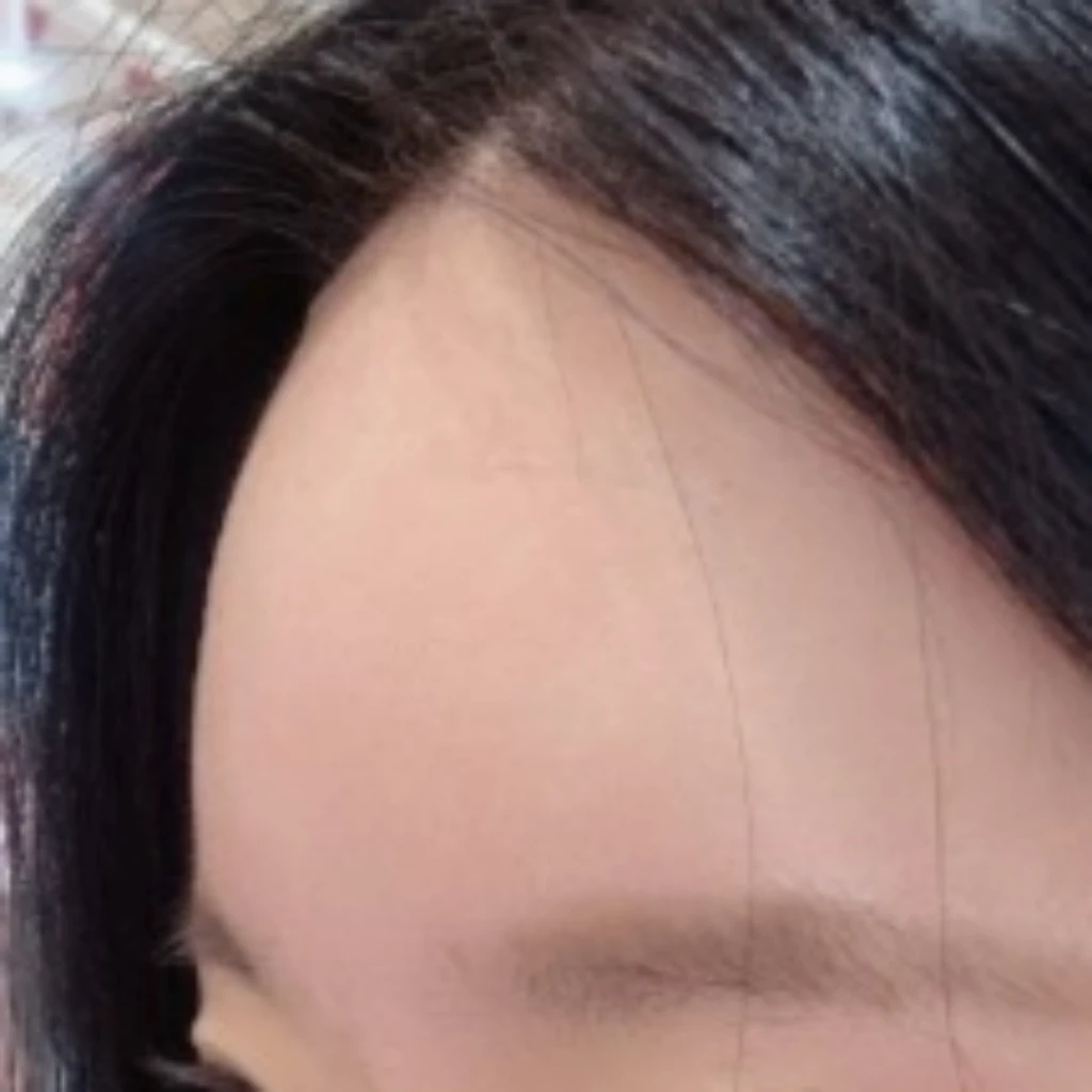 before_image