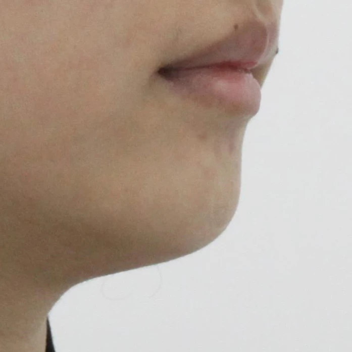 before_image