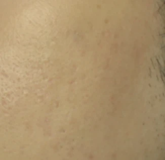 before_image
