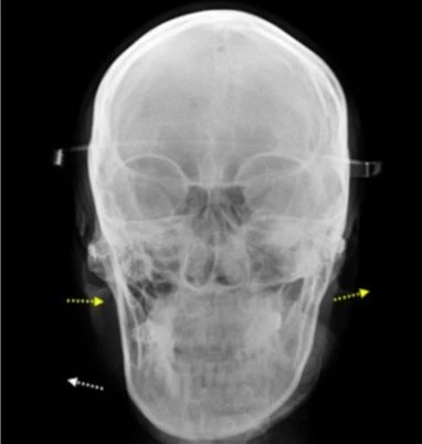 before_image