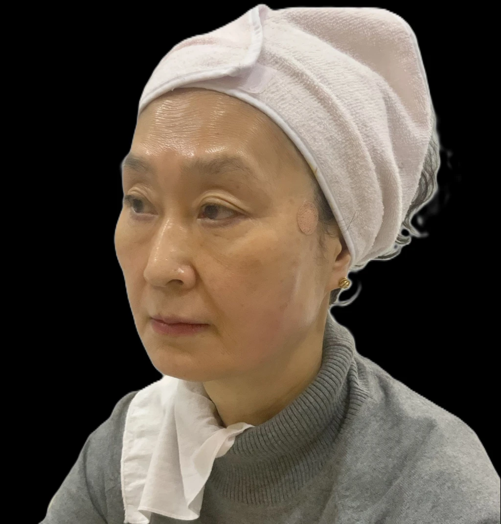 before_image