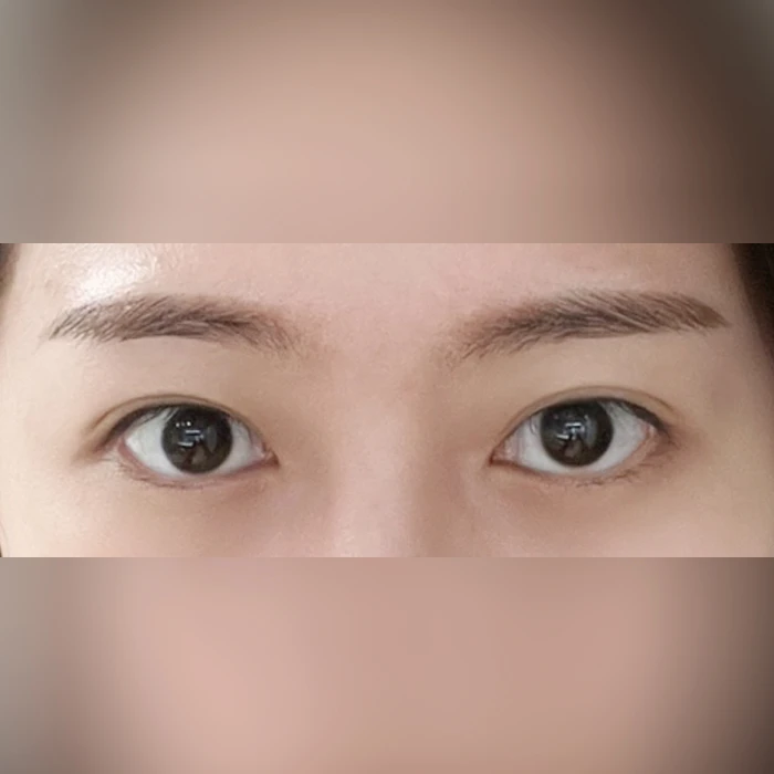 before_image