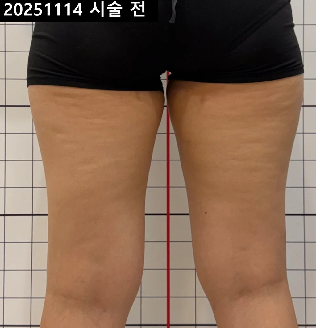 before_image