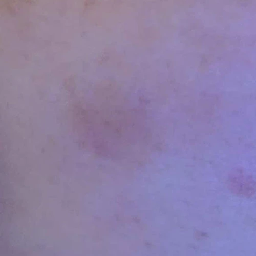 before_image