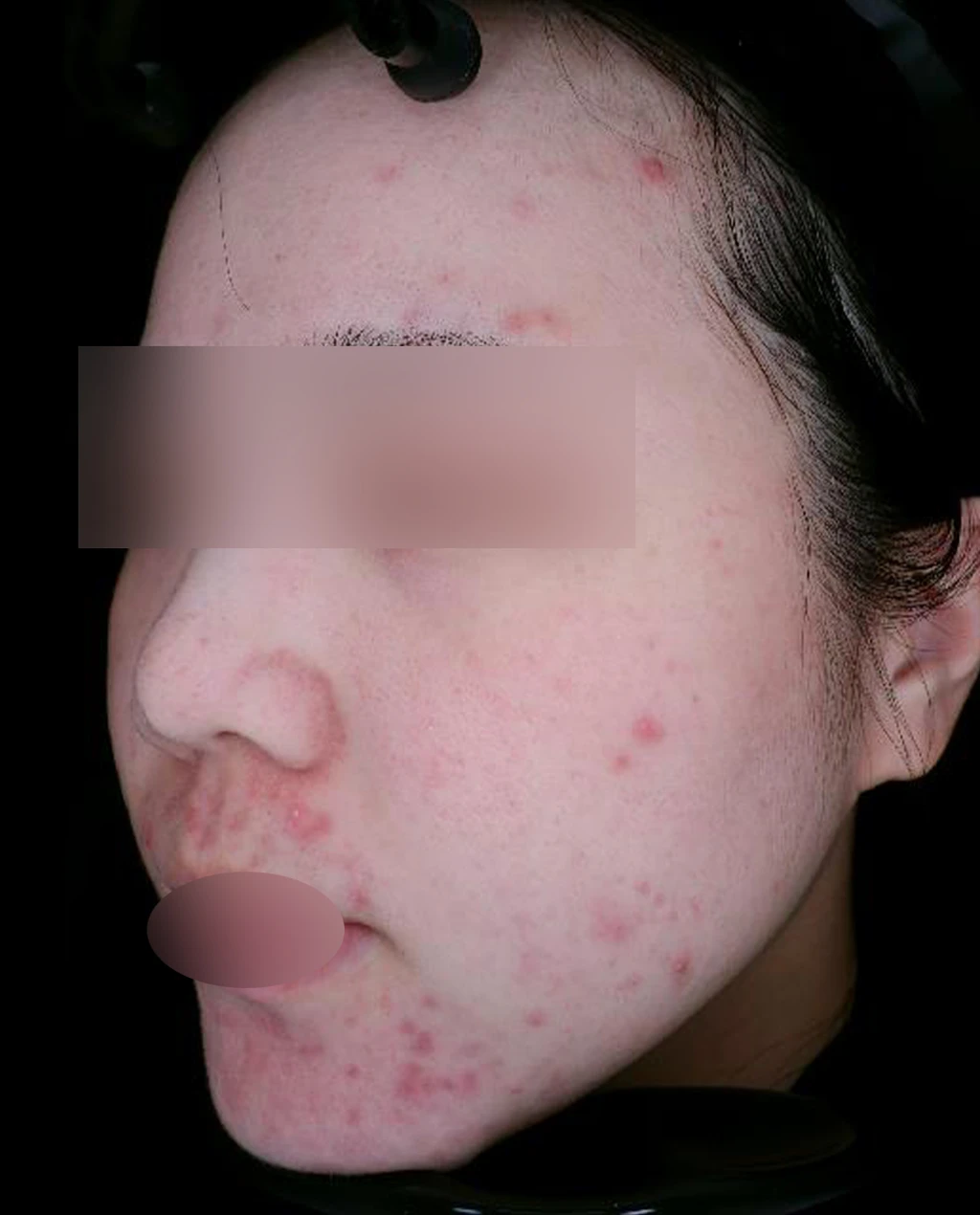 before_image