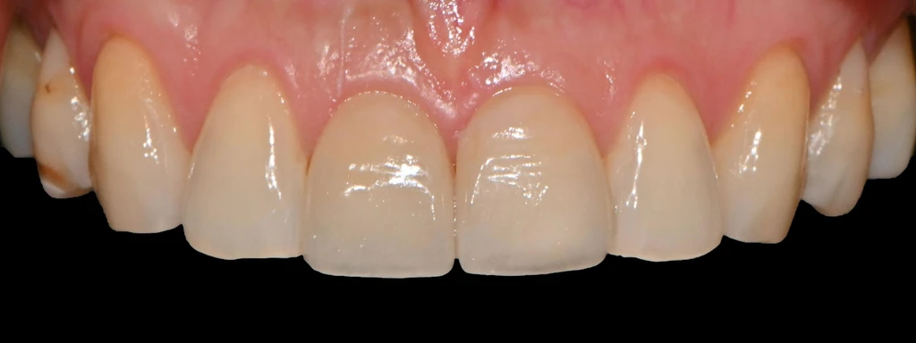 before_image