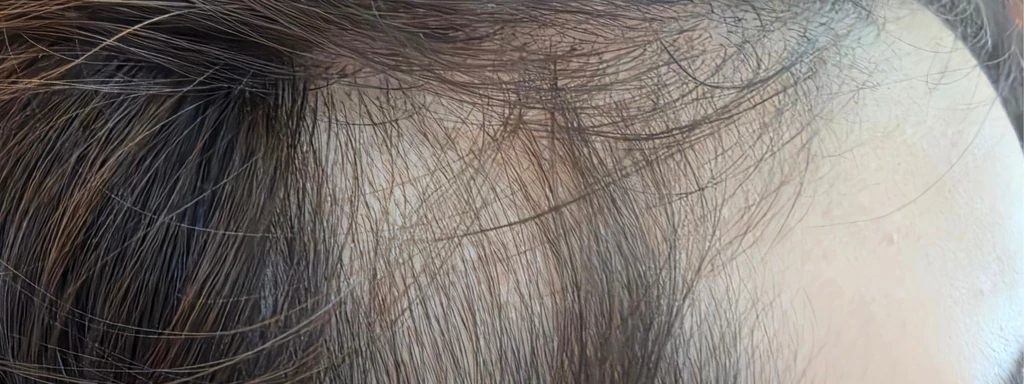 before_image