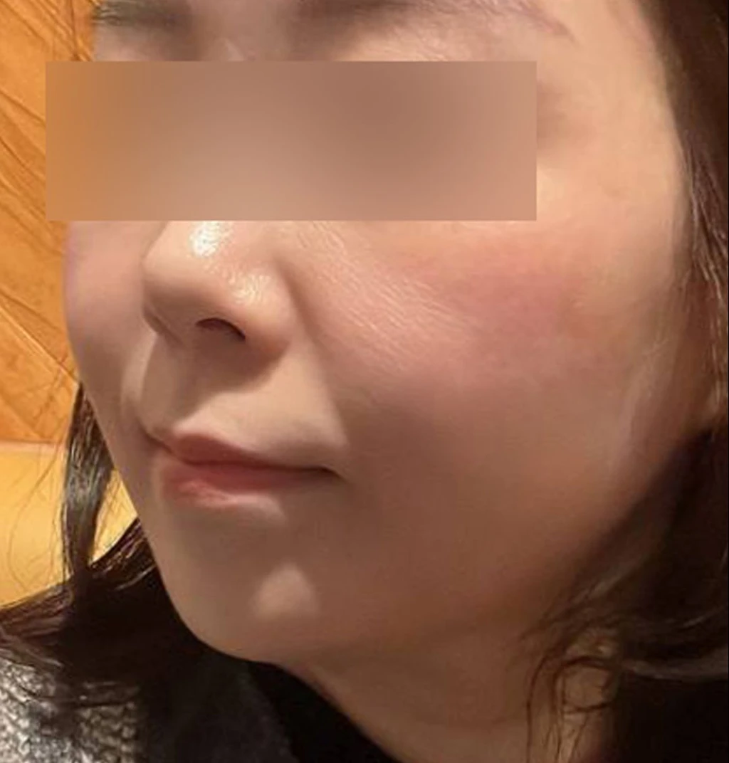 before_image