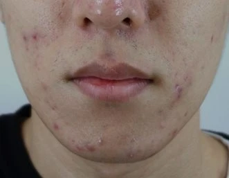 before_image
