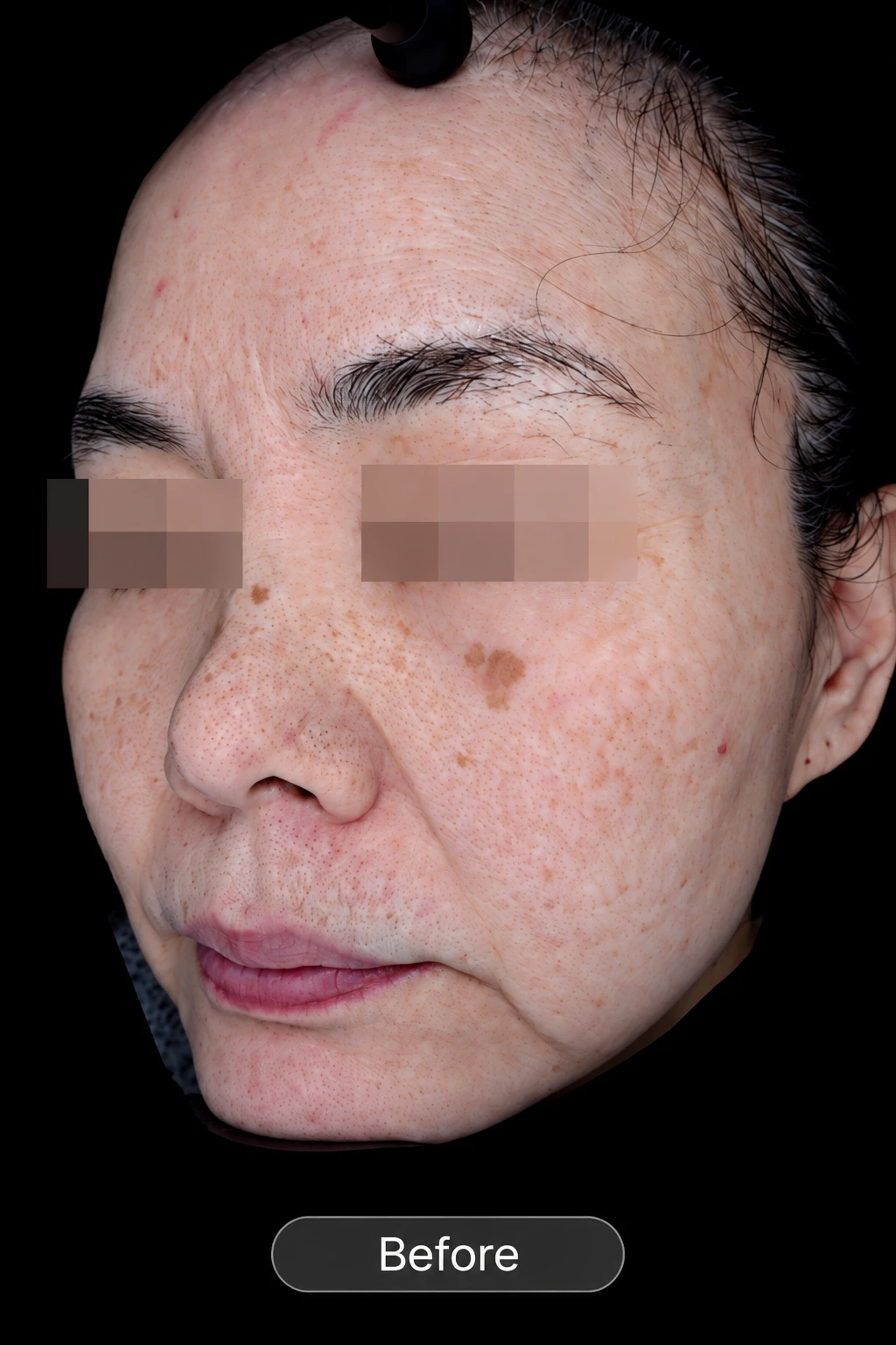 before_image
