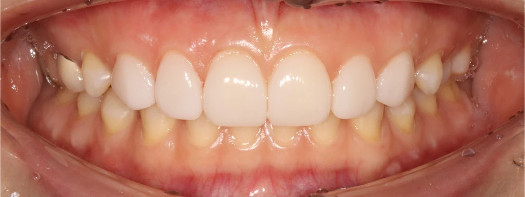 before_image