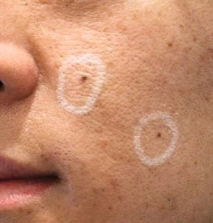 before_image