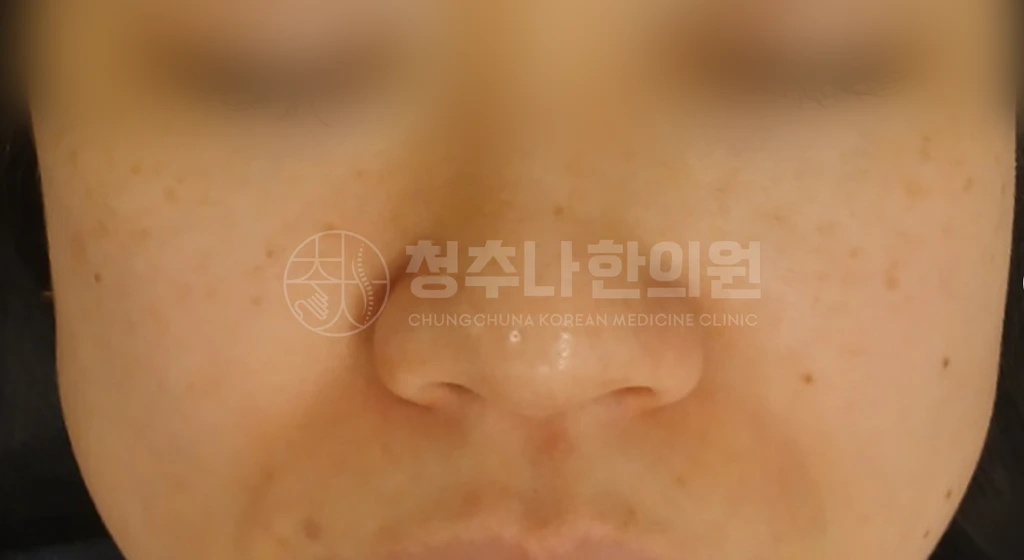 before_image