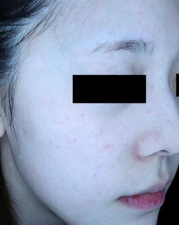 before_image
