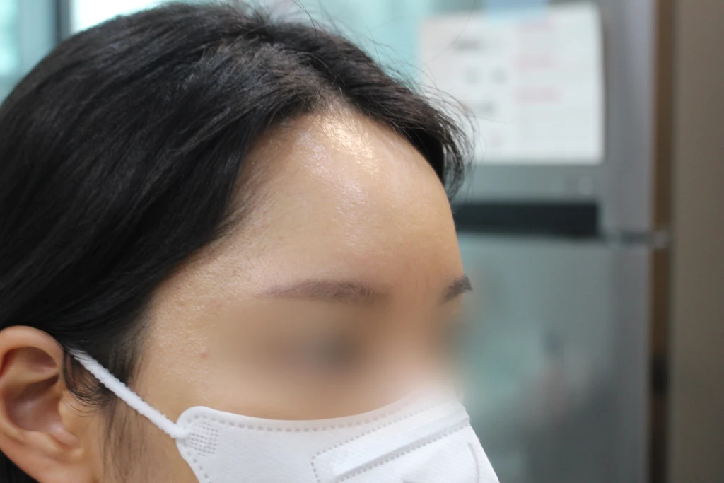 before_image