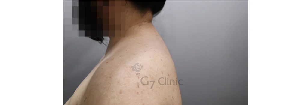 before_image
