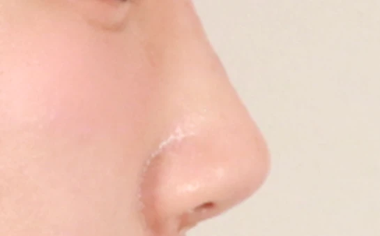 before_image