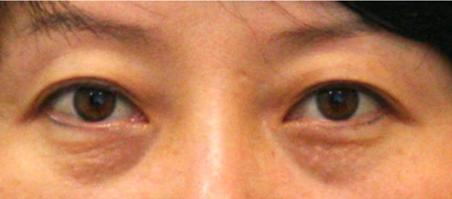 before_image