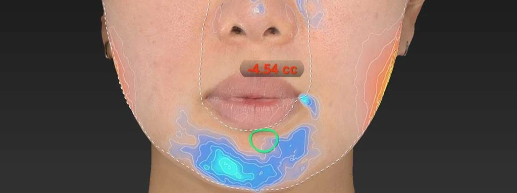 before_image