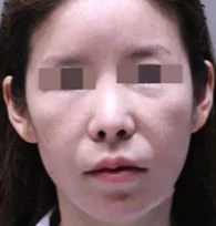 before_image