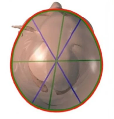 before_image