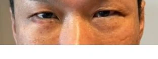 before_image