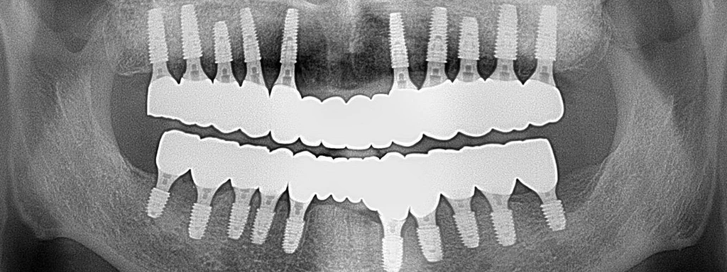 before_image