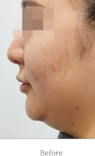 before_image