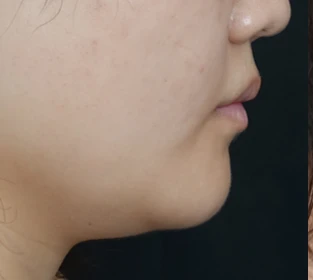 before_image