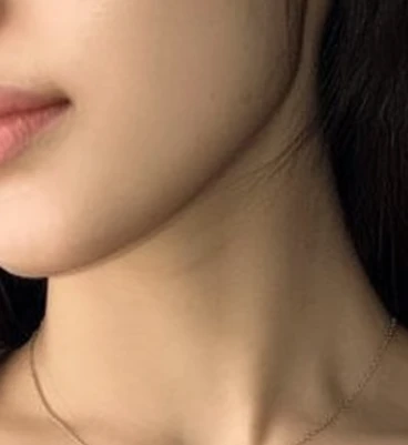 before_image