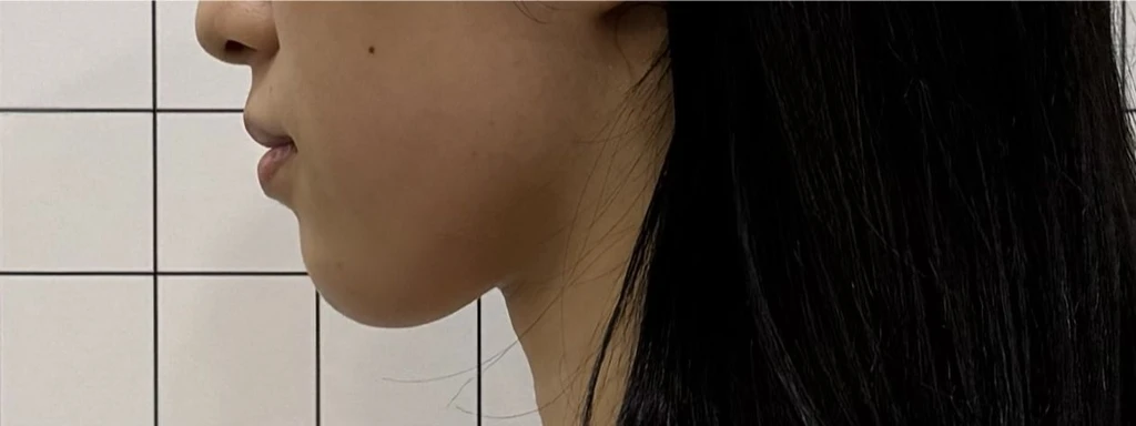 before_image