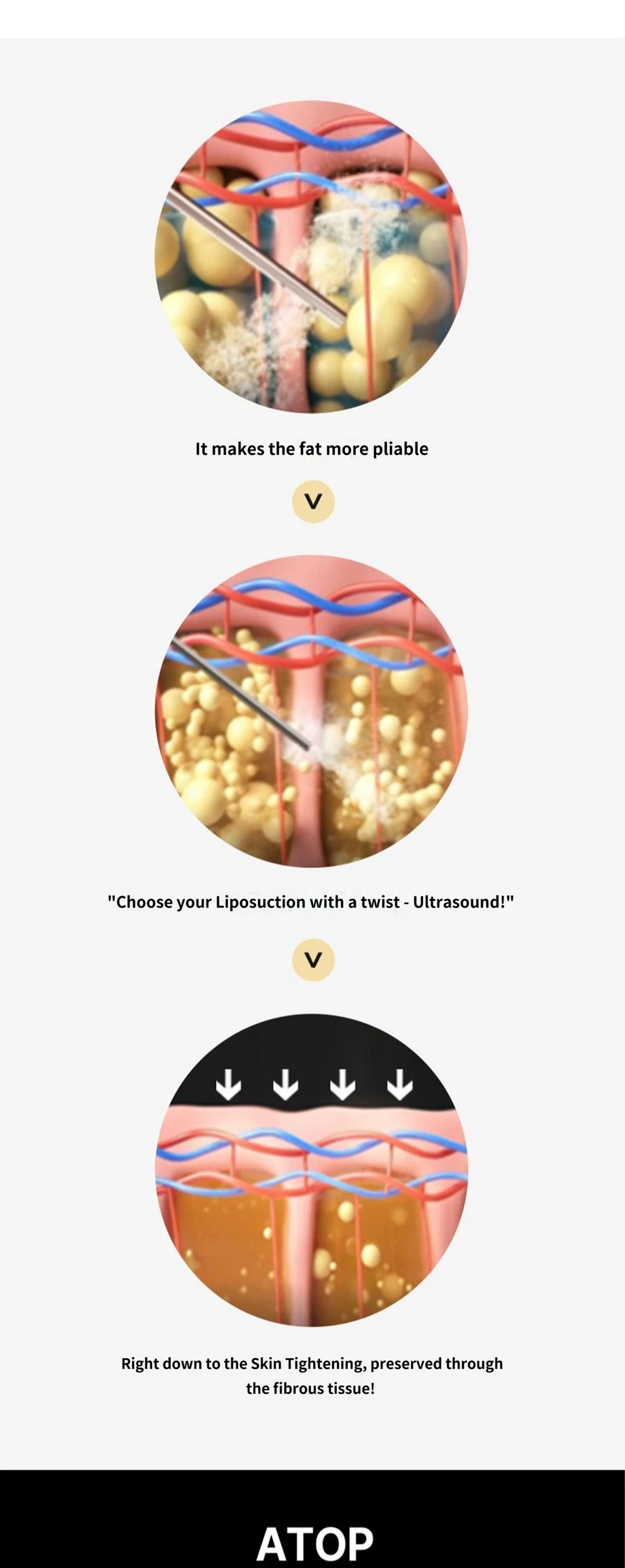 treatmentIntroduction