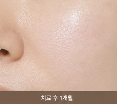 before_image