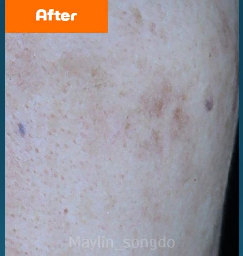 before_image