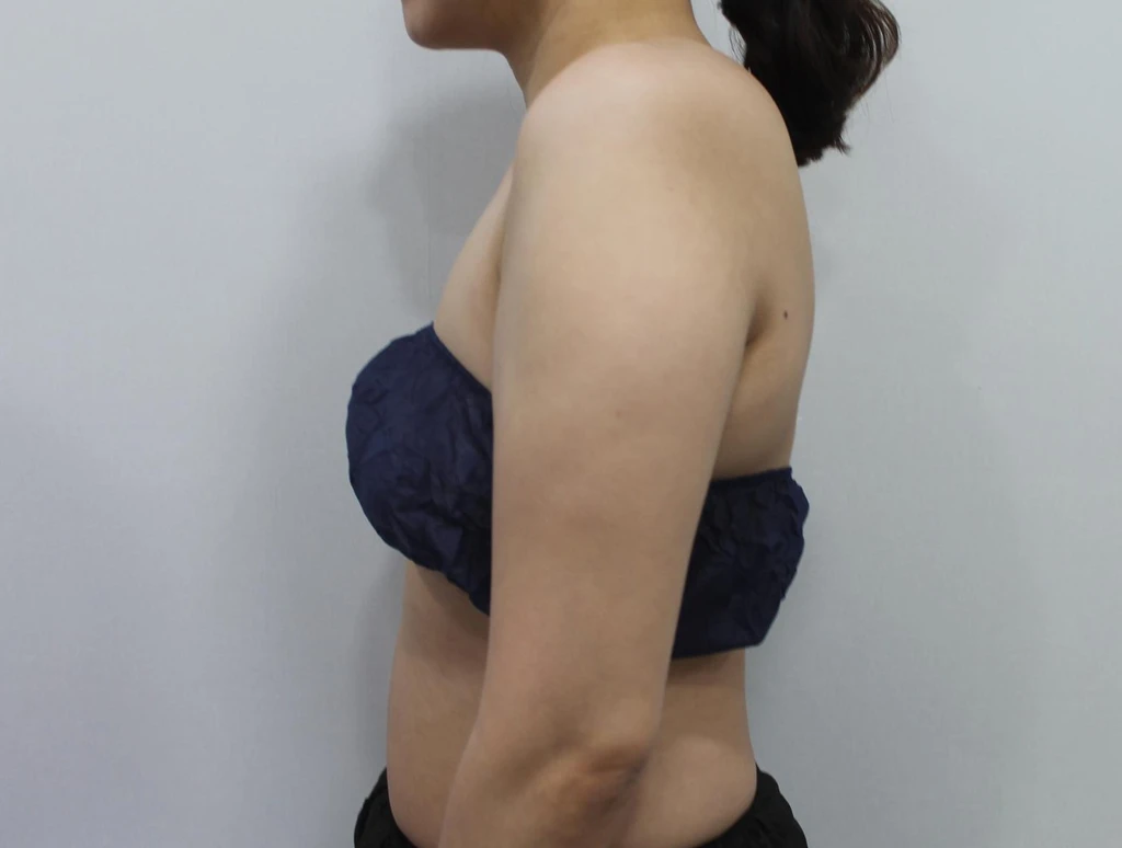 before_image