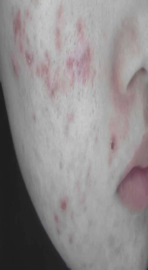 before_image