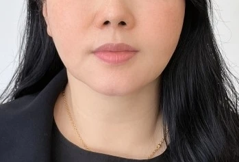 before_image