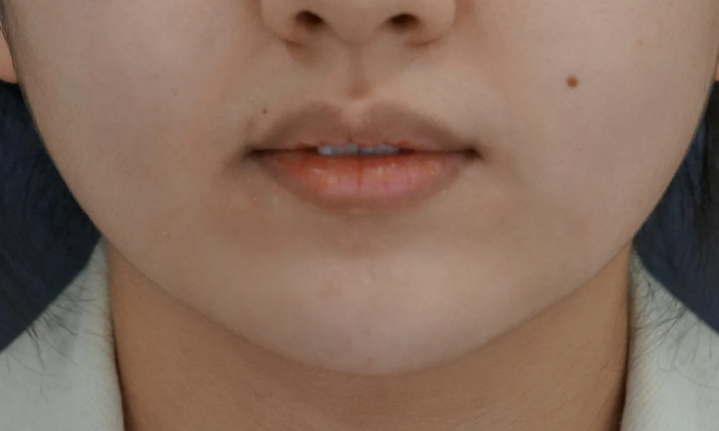 before_image
